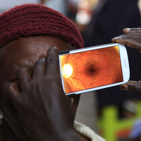 Sensor voor oog